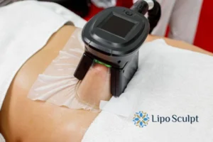 Cryolipolysis Helping You Getting that Perfect Summer Body 3 Cryolipolysis Hertfordshire can give you the best summer body - contact us today!