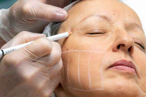 CryoPen: 5 Skin Concerns It May Be Used to Treat 4 What should you ask before having CryoPen treatment Hertfordshire?