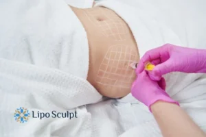 Are The Results From Aqualyx Permanent? 1 Do you want to know how long Aqualyx Hertfordshire results last?