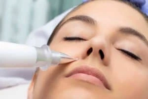 Best Actinic Keratoses Removal 3 Actinic keratoses Hertfordshire solutions - book in today!