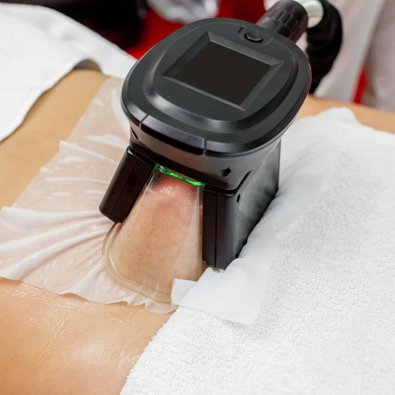 Fat Freezing treatment Hertfordshire